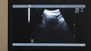 Dr Wolf watches the x-ray screen as he press his cock against Austin Young's hole