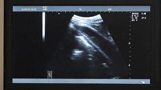 Dr Wolf watches the x-ray screen as he press his cock against Austin Young's hole