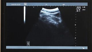Dr Wolf watches the x-ray screen as he press his cock against Austin Young's hole