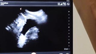FunsizePorn.com - Tiny Tom Bentley have no choice but to watch his ass get drilled by