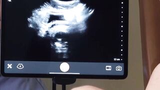 FunsizePorn.com - Kinky hunk Dr Wolf bangs young Joshua Oaks during prostate examinat