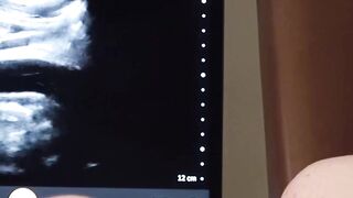FunsizePorn.com - Kinky hunk Dr Wolf bangs young Joshua Oaks during prostate examinat