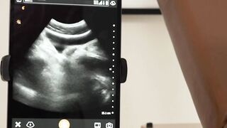 FunSizeBoys Doctor Legrand Wolf and Logan Cross exam room fucking