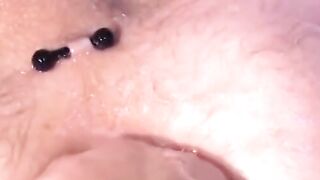 InfernoDungeon.com - Intense gay fisting session results in a wide gaping asshole