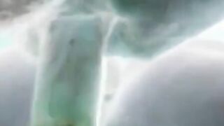 X-ray sex
