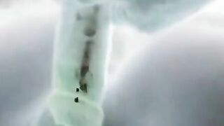 X-ray sex