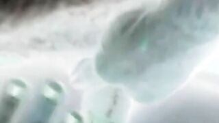 X-ray sex