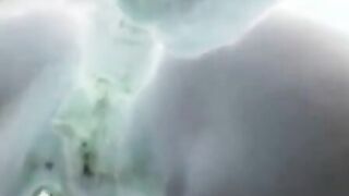 X-ray sex