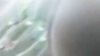 X-ray sex
