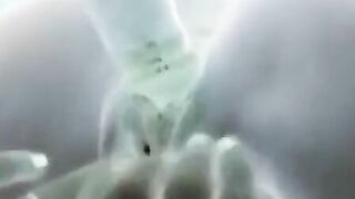 X-ray sex