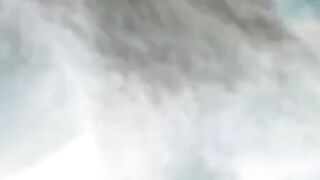 X-ray sex
