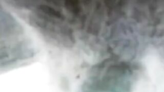 X-ray sex