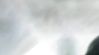 X-ray sex