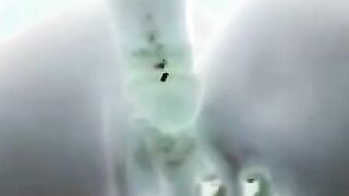 X-ray sex