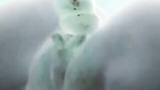 X-ray sex