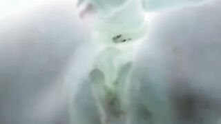 X-ray sex