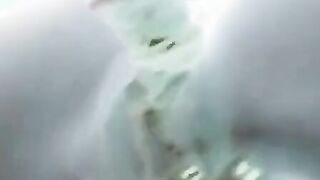 X-ray sex