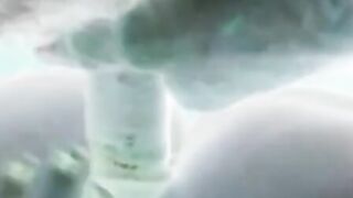 X-ray sex