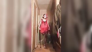 amputee