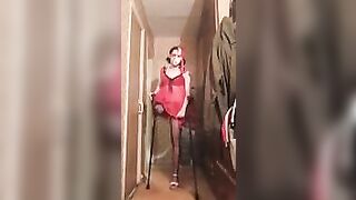 amputee