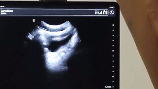 BoysFunSize.com - Tom Bentley watches Dr Wolf drill his ass during an exam