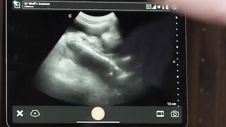 Doctor Legrand Wolf ultrasound anal fuck Grant Ducati