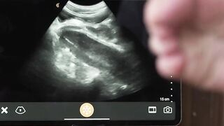 Doctor Legrand Wolf ultrasound anal fuck Grant Ducati