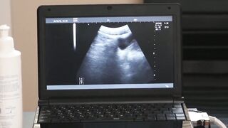 The Doctors Perfect Fit