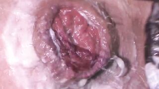 Double Teamed Masons gaping hole gets a workout