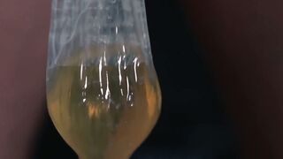 Piss Frenzy Yoshi Kawasakis Urine Odyssey