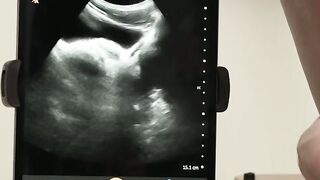Doctors Orders A Balky Beloveds Anal Adventure