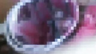 クスコの嵐山芋二穴淫姦強制クスコ活どじょう責め