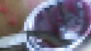 クスコの嵐山芋二穴淫姦強制クスコ活どじょう責め
