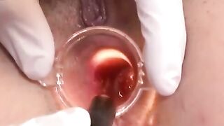 Operation Pleasure Hoe 2