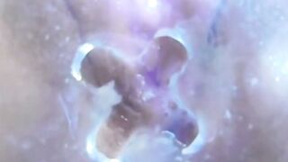 コエバキの秘密