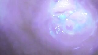 コエバキの秘密