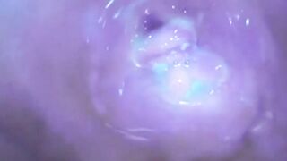 コエバキの秘密