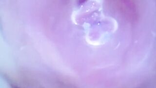 コエバキの秘密