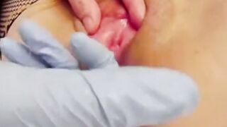 コエバキの秘密