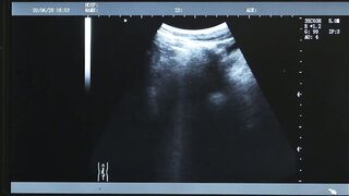 The Docs Delight Bareback Bliss for the Petite Princess