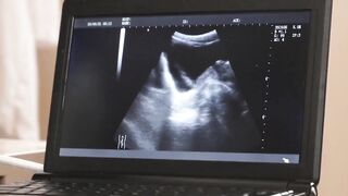 "Daddys Fingers & Big Dick Wreck Step-Son's Ass - Anal Training"