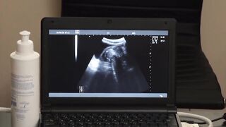 Flamed Youth Under the Surgeons Sizzling Anal Blade