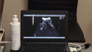 Flamed Youth Under the Surgeons Sizzling Anal Blade
