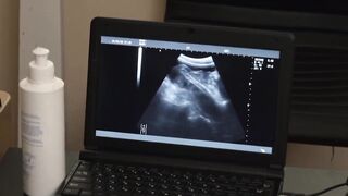 Flamed Youth Under the Surgeons Sizzling Anal Blade