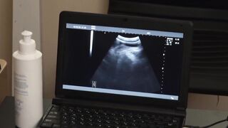 Flamed Youth Under the Surgeons Sizzling Anal Blade