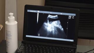 Flamed Youth Under the Surgeons Sizzling Anal Blade