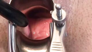"Doctor's Orders - Spread Eagle Creampie"