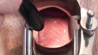 "Doctor's Orders - Spread Eagle Creampie"