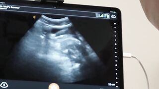 Hot Doctor-Patient Scenario #2 - Big Dick Surgeon Fucks His Patients Wife