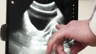 Ass Checkup - Anal Inspection with Doctor Reveals Secrets of Asshole